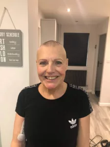 Photo of Gill after her hair was shaved.