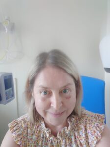 Clare McMillan during treatment - vomiting caused black eyes
