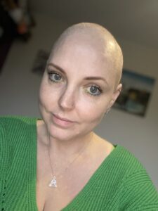 Tara during treatment